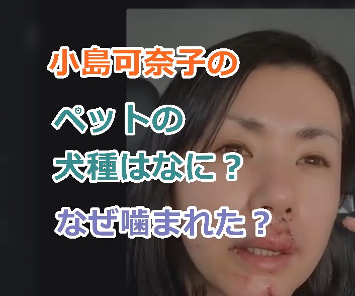 小島可奈子さんのペットの犬種はなに?なぜ飼っている犬に噛まれた?