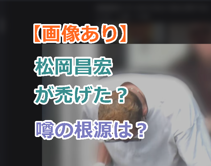 【画像あり】松岡昌宏が禿げた?と話題になったがなんで?ハゲた真相と噂の根源は?